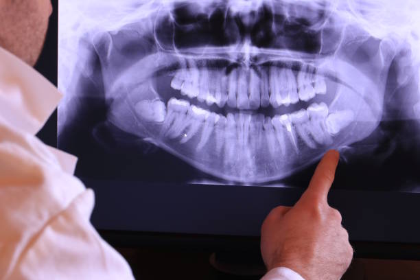 Best Emergency Tooth Extraction in Middle Valley, TN